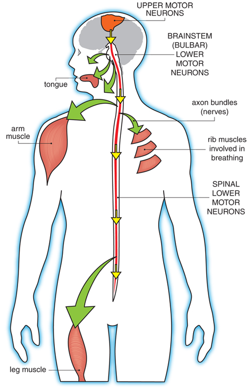 Figure 1: Upper motor neurons normally send signals to lower motor neurons, which send signals to muscles.