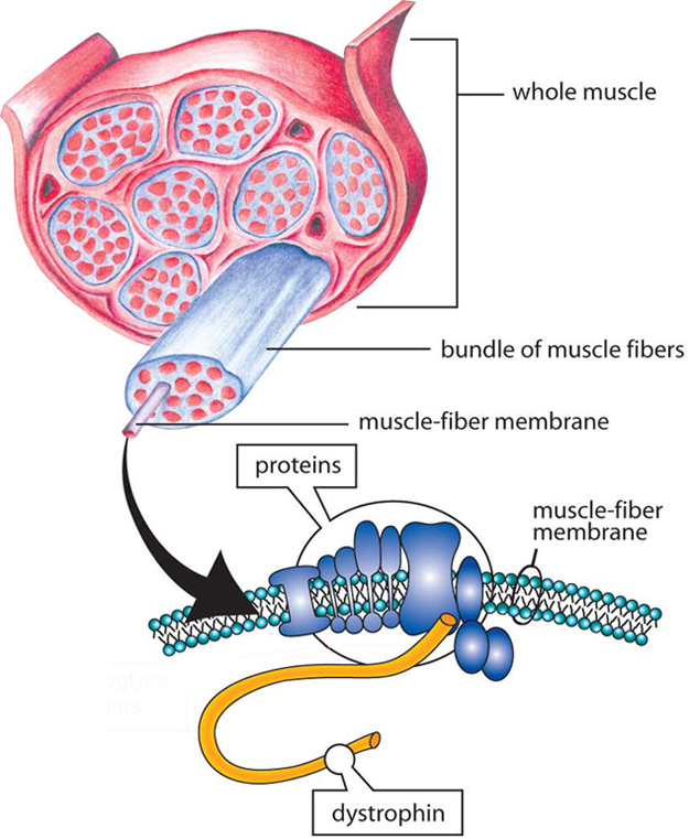 Muscles are made up of bundles of fibers (cells). A group of interdependent proteins along the membrane surrounding each fiber helps to keep muscle cells working properly. When one of these proteins, dystrophin, is absent, the result is Duchenne muscular dystrophy (DMD); poor or inadequate dystrophin results in Becker muscular dystrophy (BMD).
