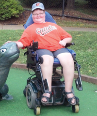 Jared Watson after his spinal fusion surgery, without a brace, at a miniature golf course.