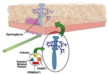 Fukutin, fukutin-related protein, POMT1 and POMGnT1 are all involved in the sugar coating of dystroglycan. Without their contributions, dystroglycan loses its ability to stick to laminin 2, and congenital MD, sometimes accompanied by eye or brain abnormalities, results.