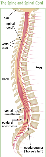 Spinal curvatures and the spinal fusion procedures sometimes used to treat them can interfere with the effectiveness of spinal or epidural anesthesia. The medication-delivering catheter for spinal anesthesia is usually placed a little higher and penetrates a little more deeply than the catheter to deliver epidural anesthesia.