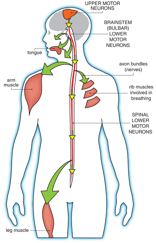 amyotrophic lateral sclerosis - Students