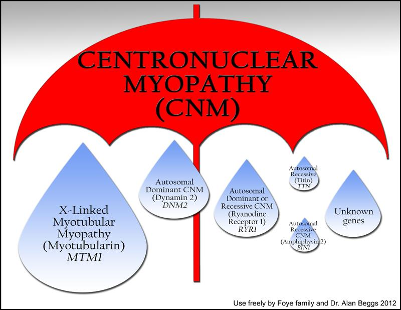 The new way of thinking about CNMs is that they're an umbrella under which X-linked MTM and other CNMs fall.