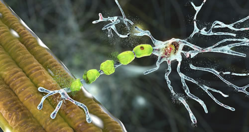 Simply Stated: Updates in Neuromuscular Junction (NMJ) Disorders