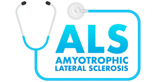 Simply Stated: Updates in Amyotrophic Lateral Sclerosis (ALS)