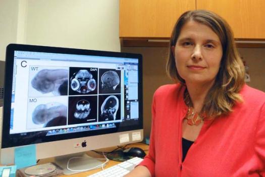 Research - Grants at a Glance - Spring 2014 | Muscular Dystrophy Association