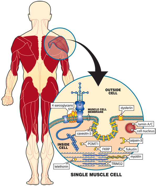 Diagrams Of People With Muscular Dystrophy