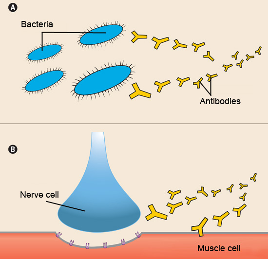 What causes myasthenia gravis?