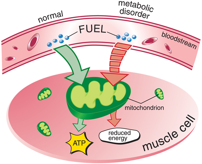 Metabolic Myopathies Causes/Inheritance Muscular Dystrophy Association