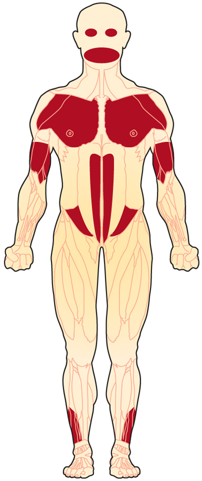 What are the most common muscular diseases?