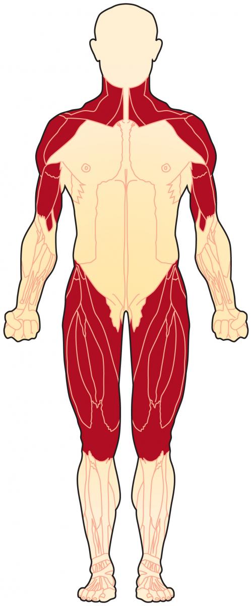 Polymyositis mostly affects the muscles of the hips and thighs, the upper arms, the top part of the back, the shoulder area and the neck.