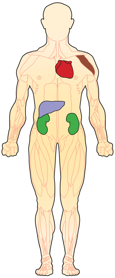 Metabolic diseases of muscle can affect all of the body's voluntary muscles, such as those in the arms, legs and trunk. Some also can involve increased risk of heart or liver disease, and the effects can damage the kidneys.