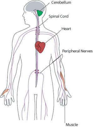 FA affects the heart and parts of the nervous system involved in muscle control and coordination.