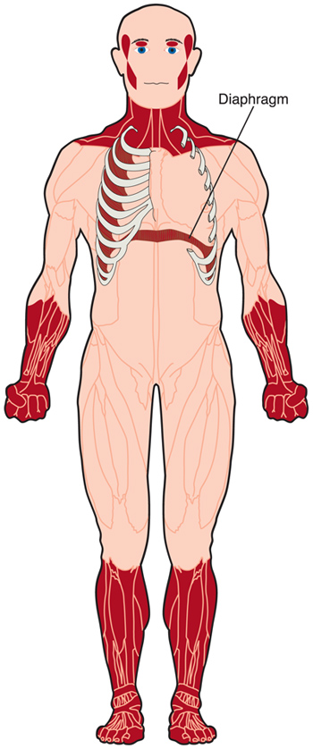 What are the different types of muscular dystrophy?