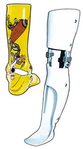 An ankle-foot orthosis (left) and a knee-ankle-foot orthosis (right).