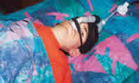 At night, Neufeldt uses nasal pillows with his ventilator.