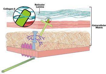 By 2003, it was clear that mutations in collagen 6, a three-stranded, ropelike protein woven through the reticular and basal laminae, were another cause of congenital MD.