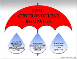 The new way of thinking about CNMs is that they're an umbrella under which X-linked MTM and other CNMs fall.