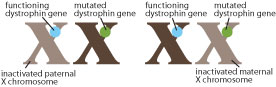 In roughly half the cells in a girl, the maternal X chromosome is inactivated (light brown). In roughly the other half, the paternal X is inactivated (light brown). If the chromosome with the functional dystrophin gene is inactivated more than about 60 percent of the time, the girl or woman can manifest symptoms of DMD.