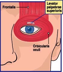 A small muscle called the levator palpebrae superioris opens the eye, while the circular orbicularis oculi closes it. When the levator is weak, the frontalis can sometimes be used to hold the eye open.