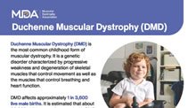 Fact sheet for Duchenne Muscular Dystrophy
