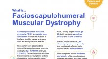 Fact sheet for Facioscapulohumeral muscular dystrophy.
