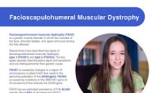 Fact sheet for Facioscapulohumeral muscular dystrophy.